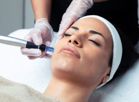 hydradermabrasion treatmentt