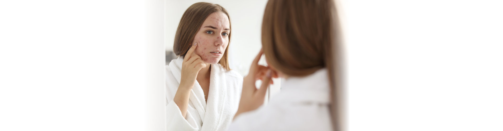 Young woman with acne problem near mirror